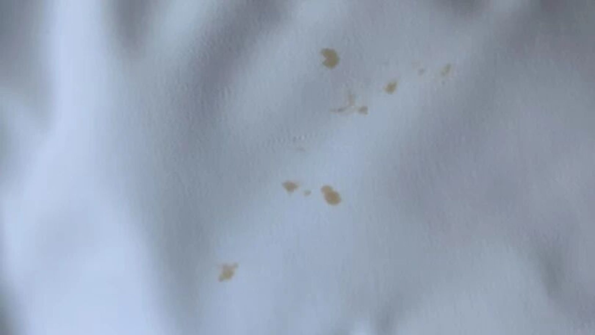 yellow-stains